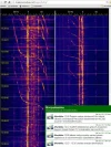 2015-07-18-1330 Useiden lentojen lähiohitusten S-dopplereita (c) OH7HJ.webp