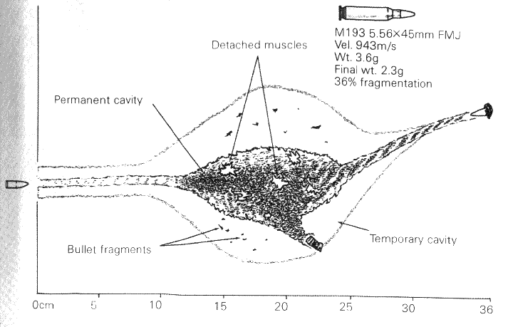 M16_5.56x45mm_wound_ballistics.gif