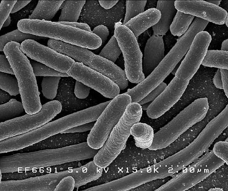 Escherichia coli -bakteeri elektronimikroskoopin kuvassa. Suolistossa majaansa pitävä kolibakteeri lienee tutkituin ja tunnetuin bakteeri.