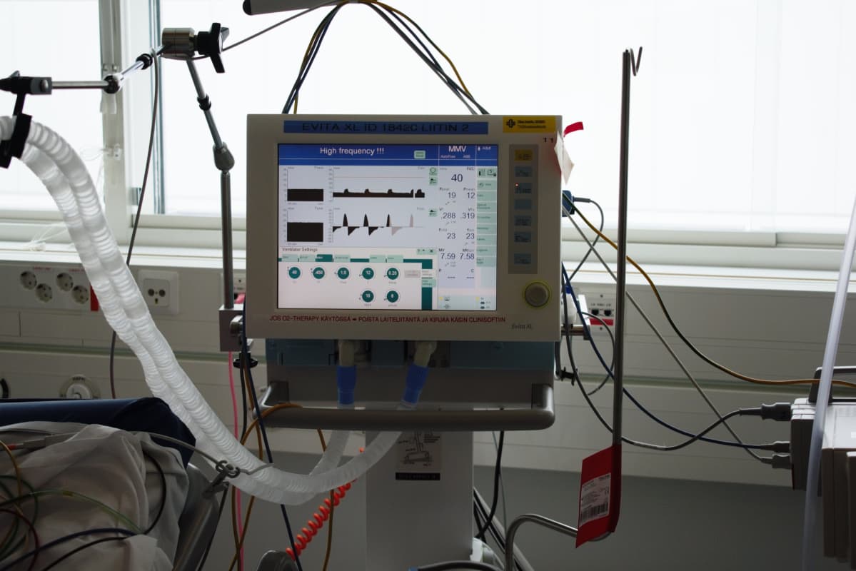 Hengityskone Tyksin teho-osastolla. Hengityskone Tyksin teho-osastolla.